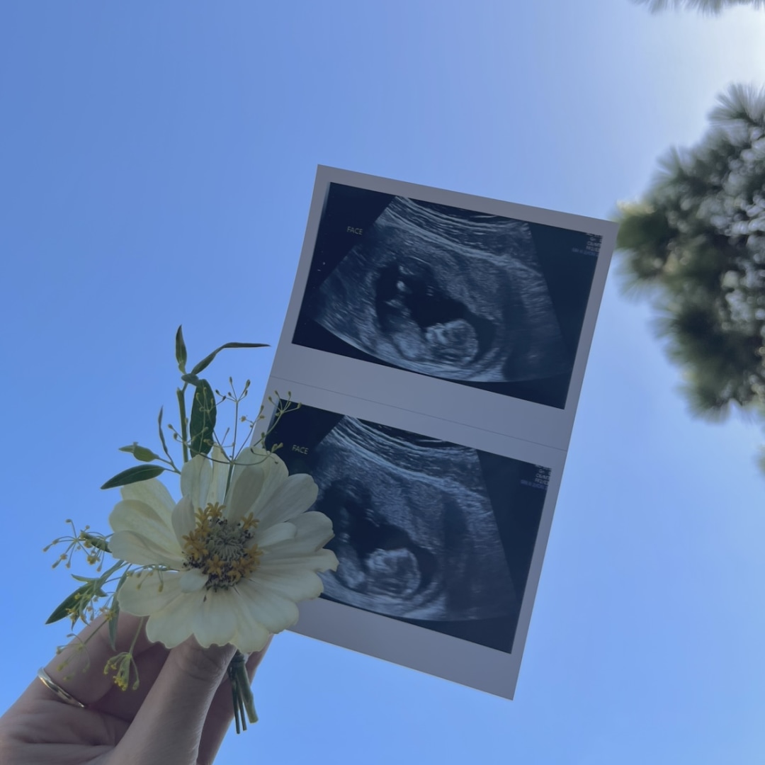 Photo shared by Alyssa for their Babylist baby registry.