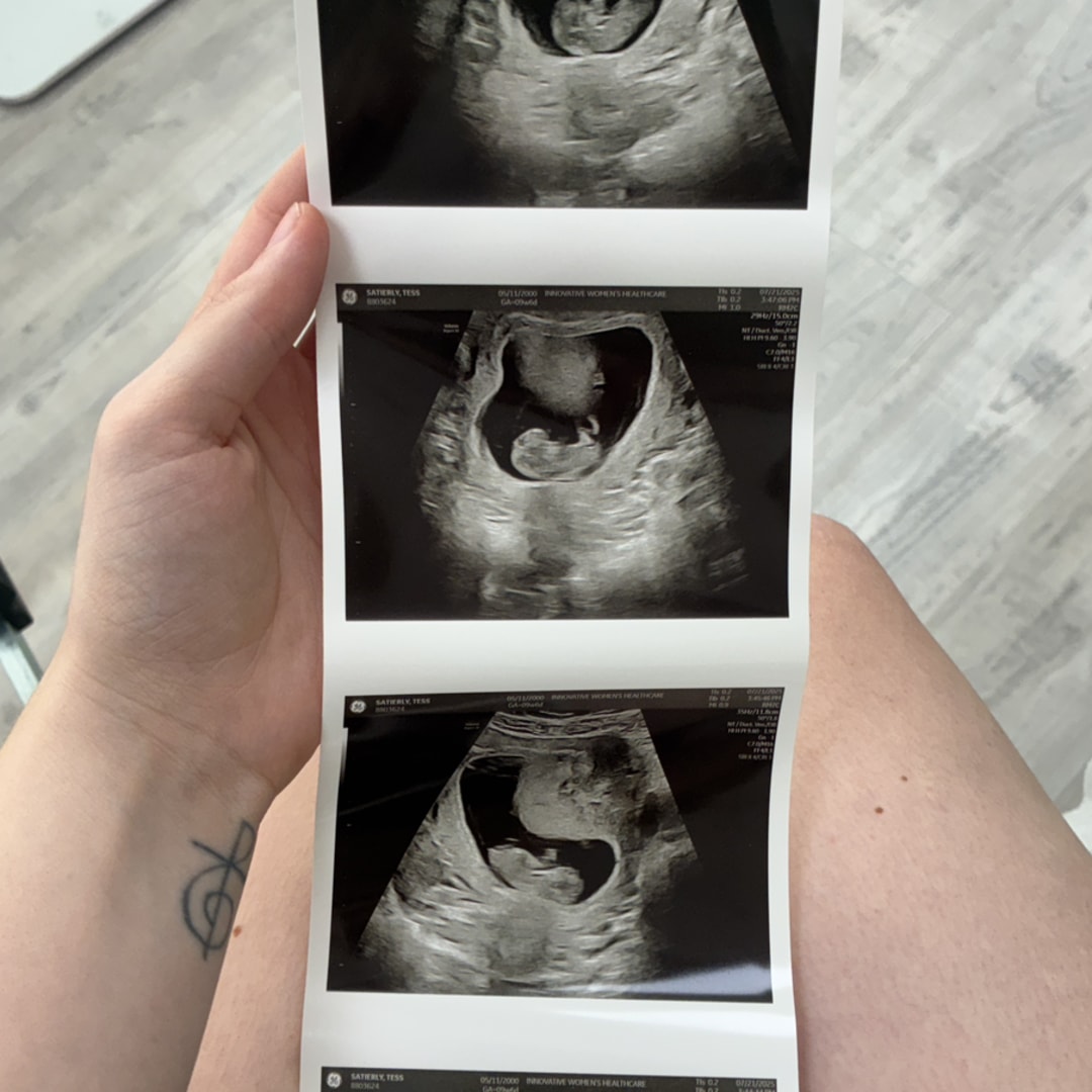 Photo shared by Tess for their Babylist baby registry.