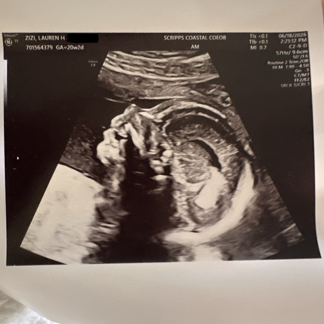 Photo shared by Lauren for their Babylist baby registry.