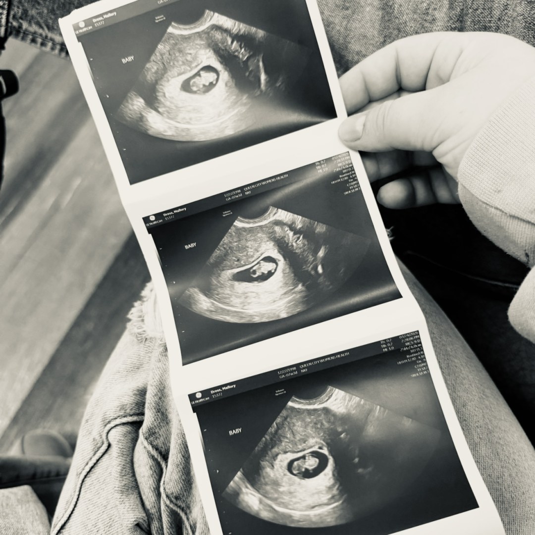 Photo shared by Mallory for their Babylist baby registry.
