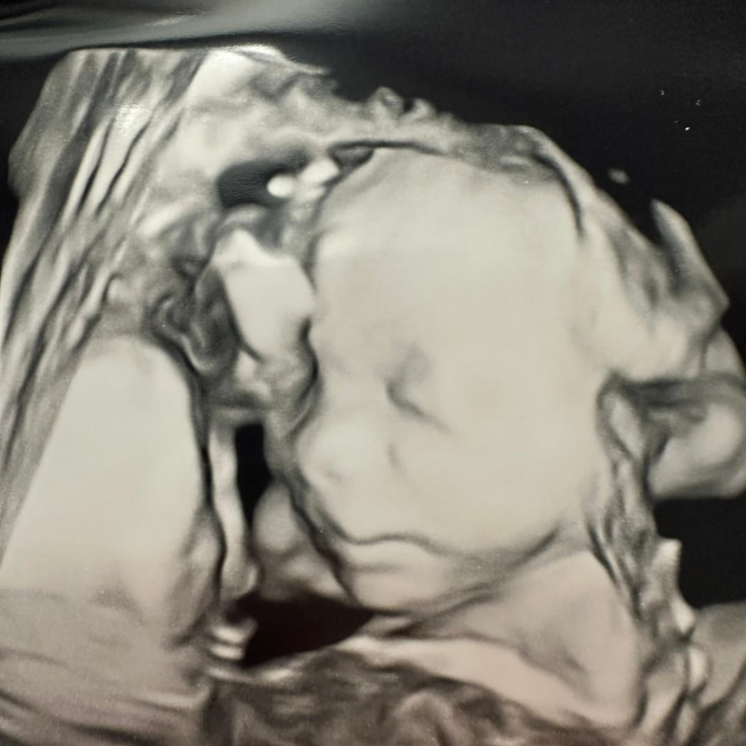 Photo shared by Angel for their Babylist baby registry.
