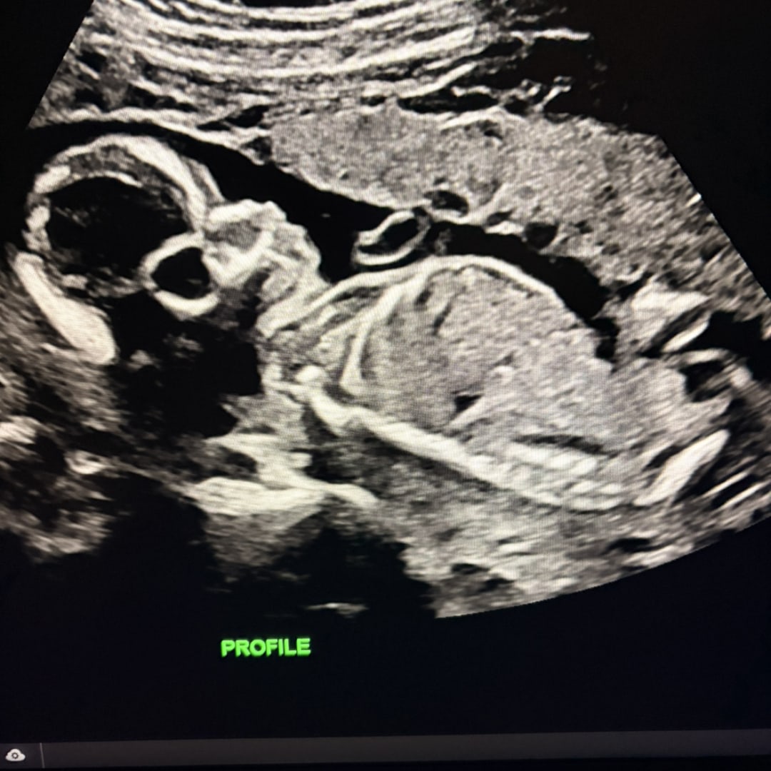 Photo shared by Haley for their Babylist baby registry.