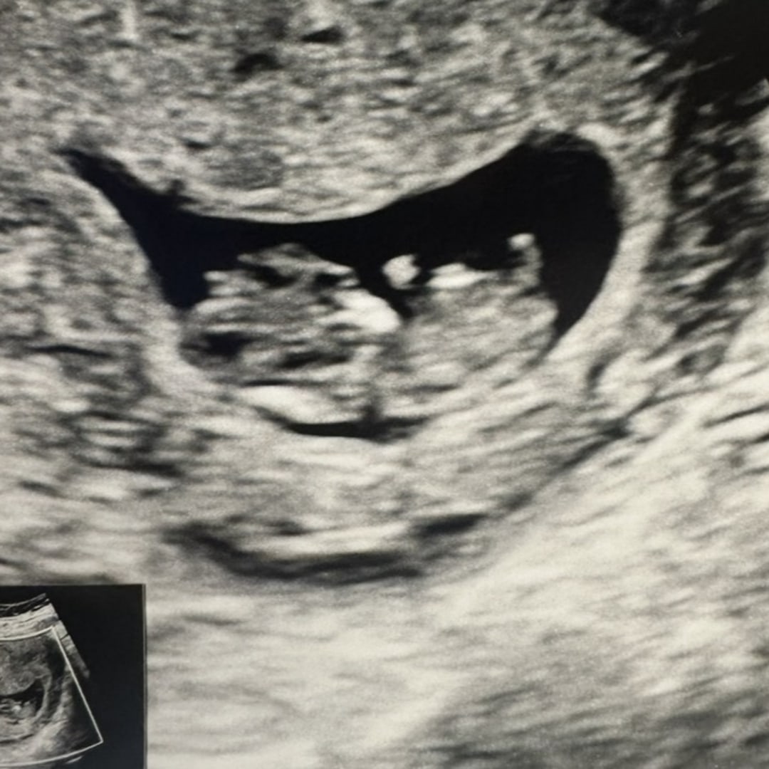 Photo shared by Brianna for their Babylist baby registry.