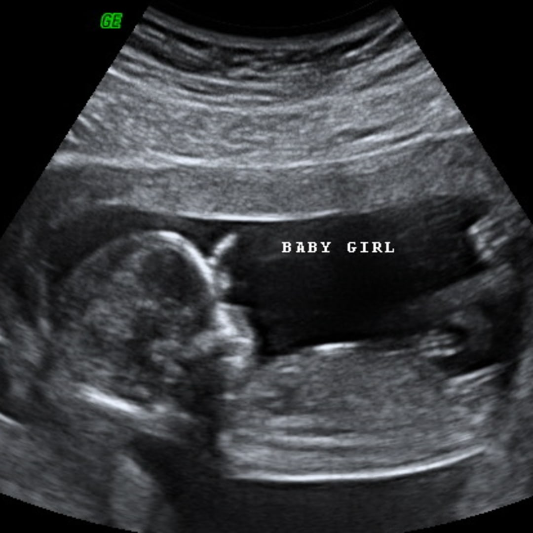 Photo shared by Jaden Blaise for their Babylist baby registry.