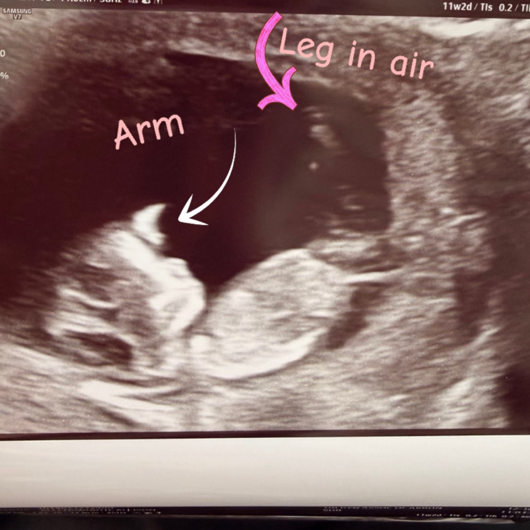 Photo shared by Allison for their Babylist baby registry.