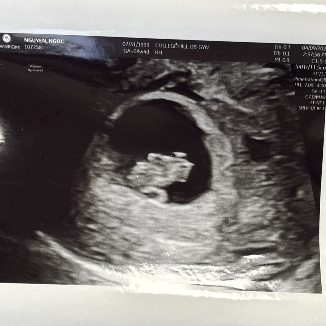 Photo shared by Davina for their Babylist baby registry.