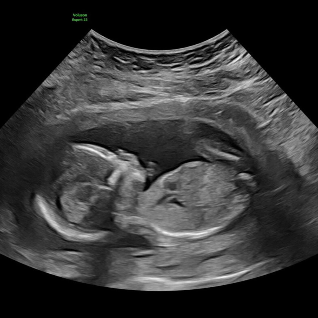 Photo shared by Liz for their Babylist baby registry.