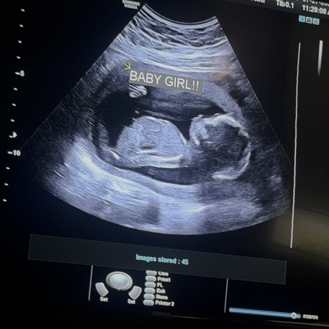 Photo shared by Alexa for their Babylist baby registry.