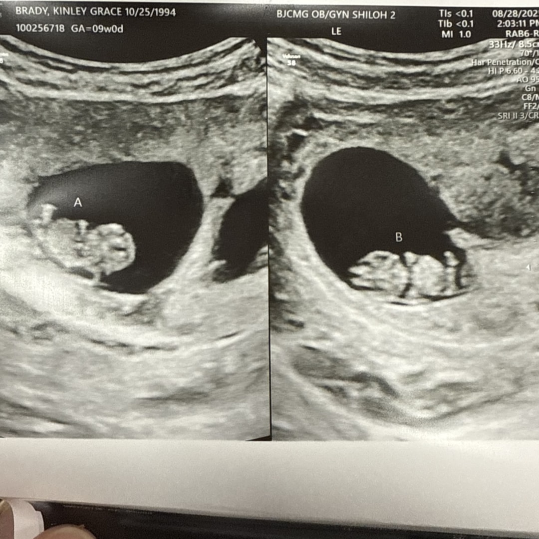 Photo shared by Kinley for their Babylist baby registry.