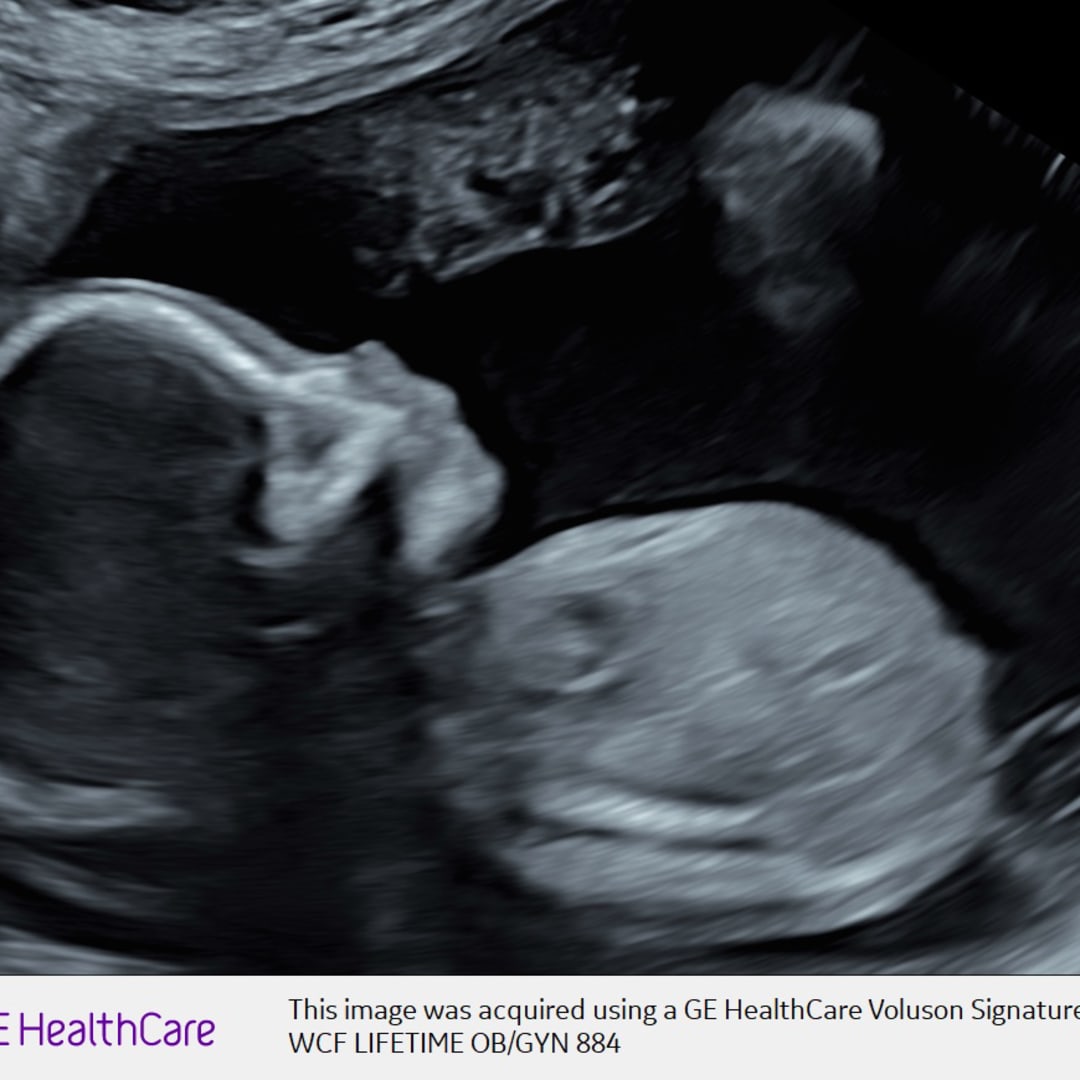 Photo shared by Victoria for their Babylist baby registry.