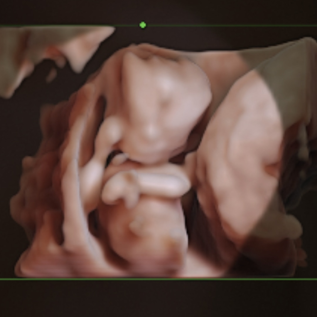 Photo shared by Sharron for their Babylist baby registry.