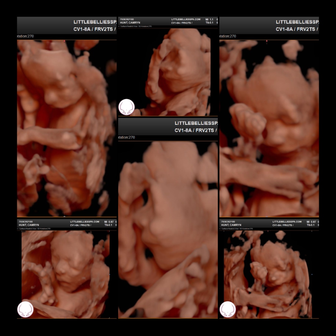 Photo shared by Camryn for their Babylist baby registry.