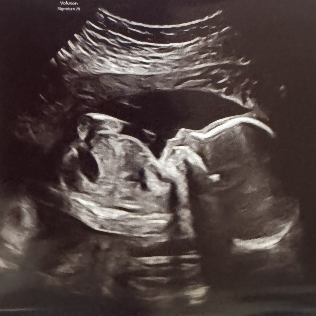 Photo shared by Kirsten for their Babylist baby registry.