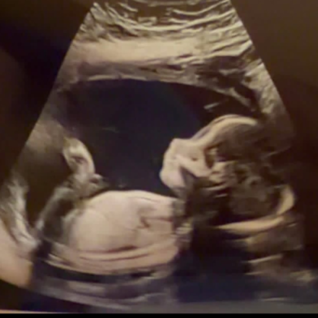 Photo shared by Shelby for their Babylist baby registry.