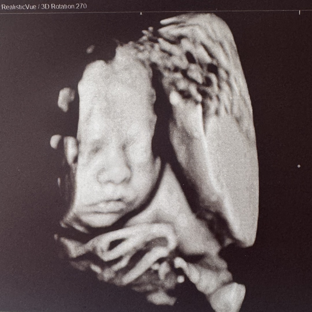 Photo shared by Alexa for their Babylist baby registry.