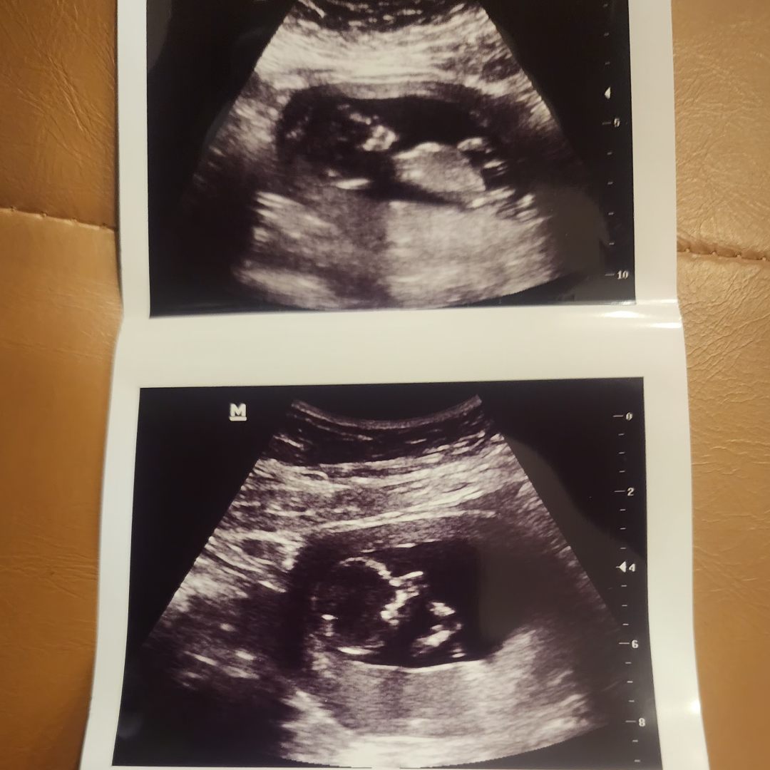Photo shared by Korionna for their Babylist baby registry.