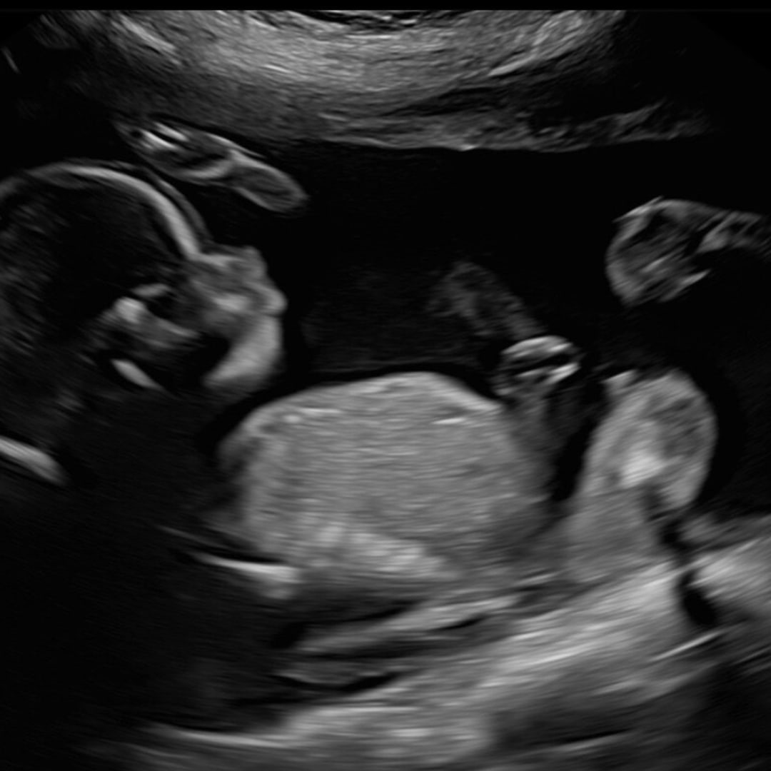 Photo shared by Grayce for their Babylist baby registry.