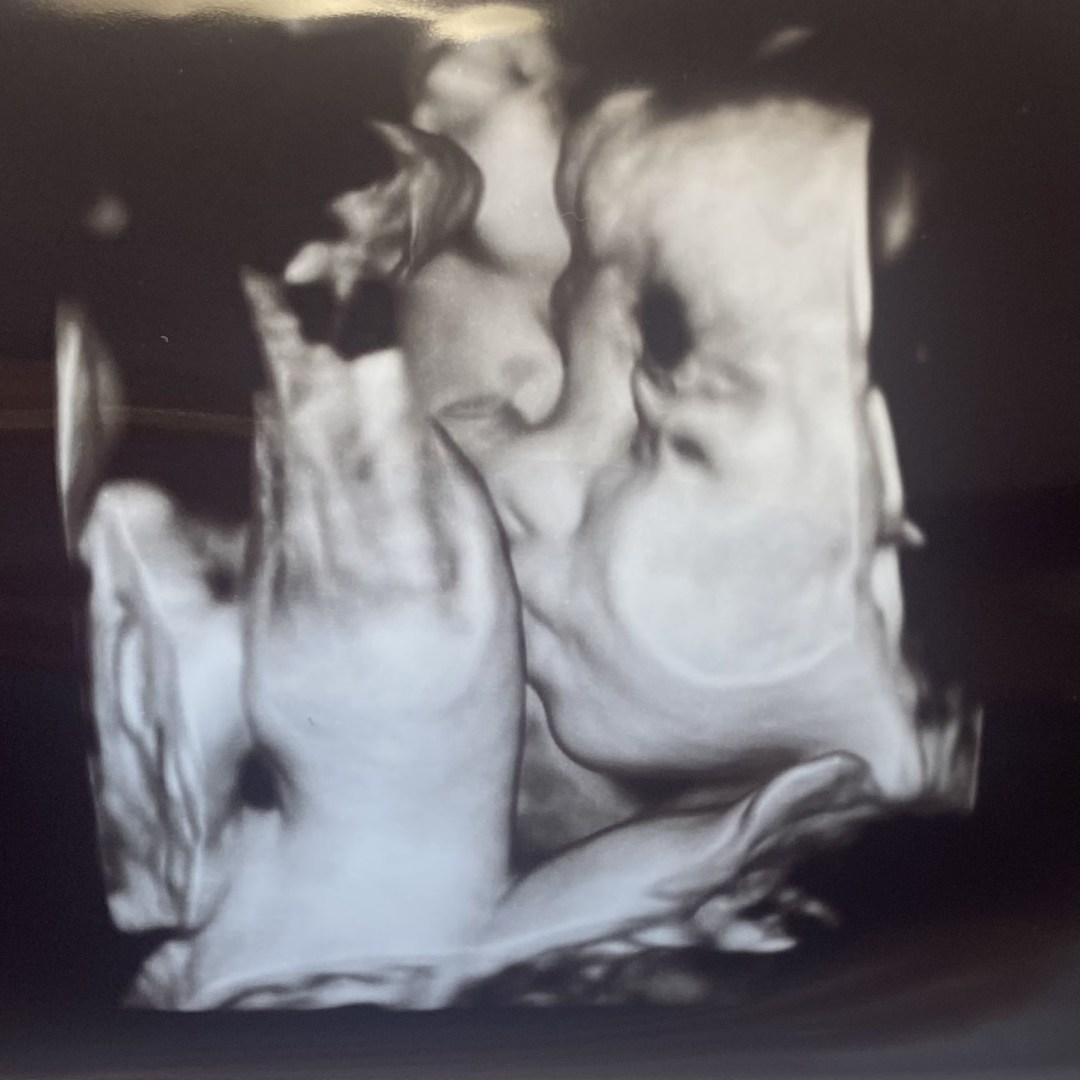 Photo shared by Brooke for their Babylist baby registry.