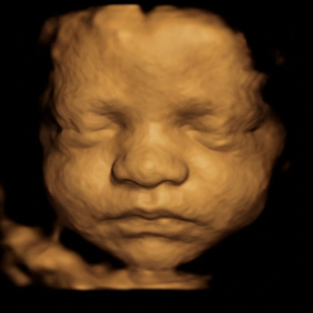 Photo shared by Samantha for their Babylist baby registry.