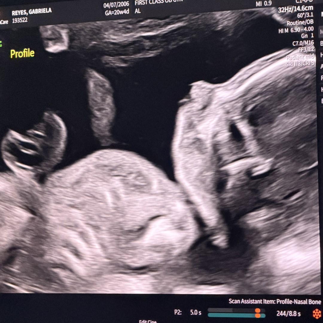 Photo shared by Gabriela for their Babylist baby registry.