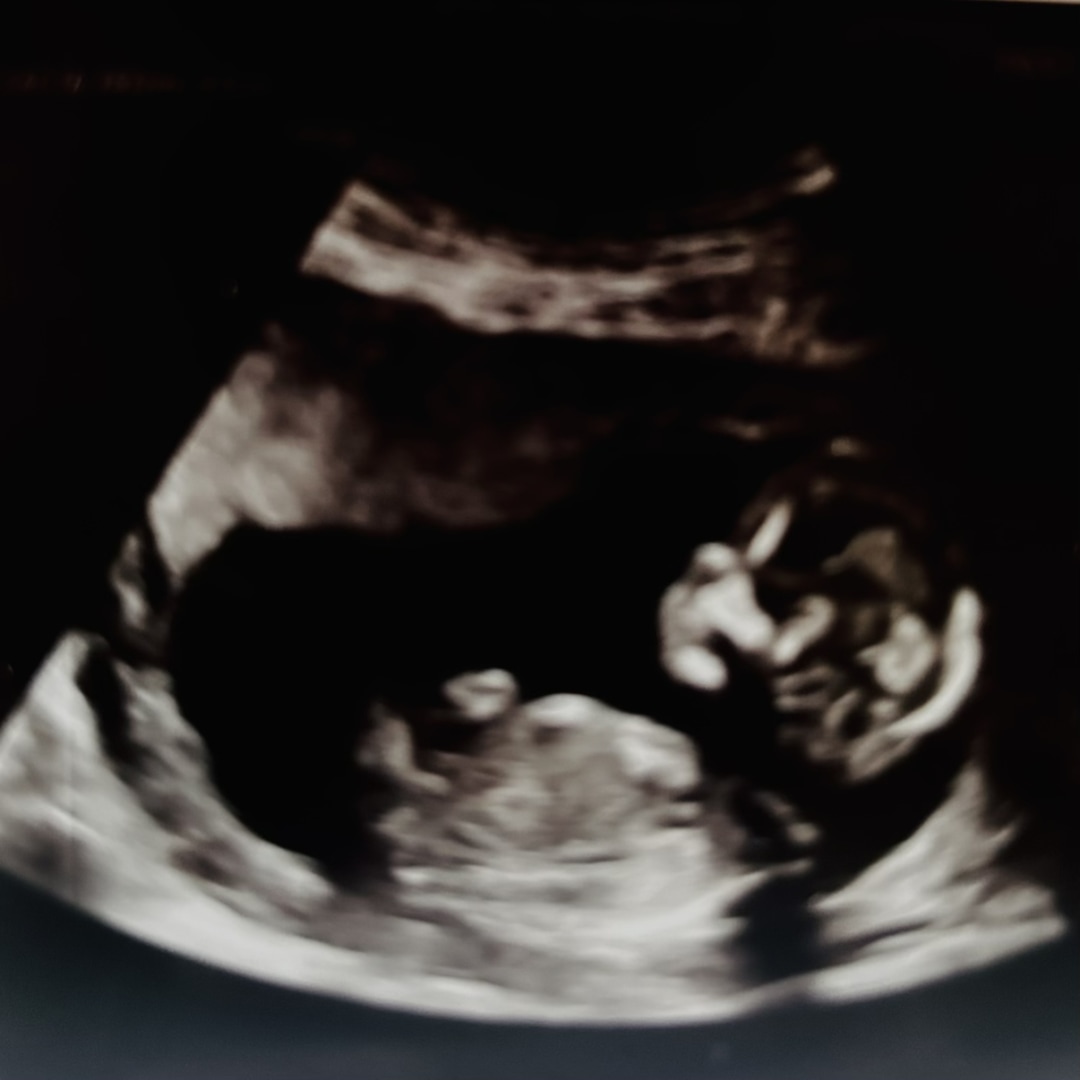 Photo shared by Chelsea for their Babylist baby registry.