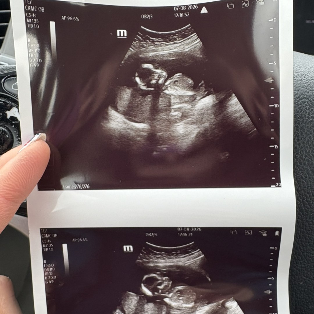 Photo shared by Colleen for their Babylist baby registry.