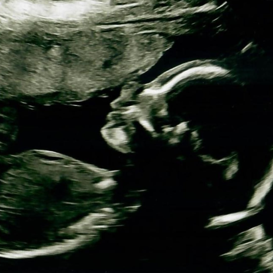 Photo shared by Jordan for their Babylist baby registry.