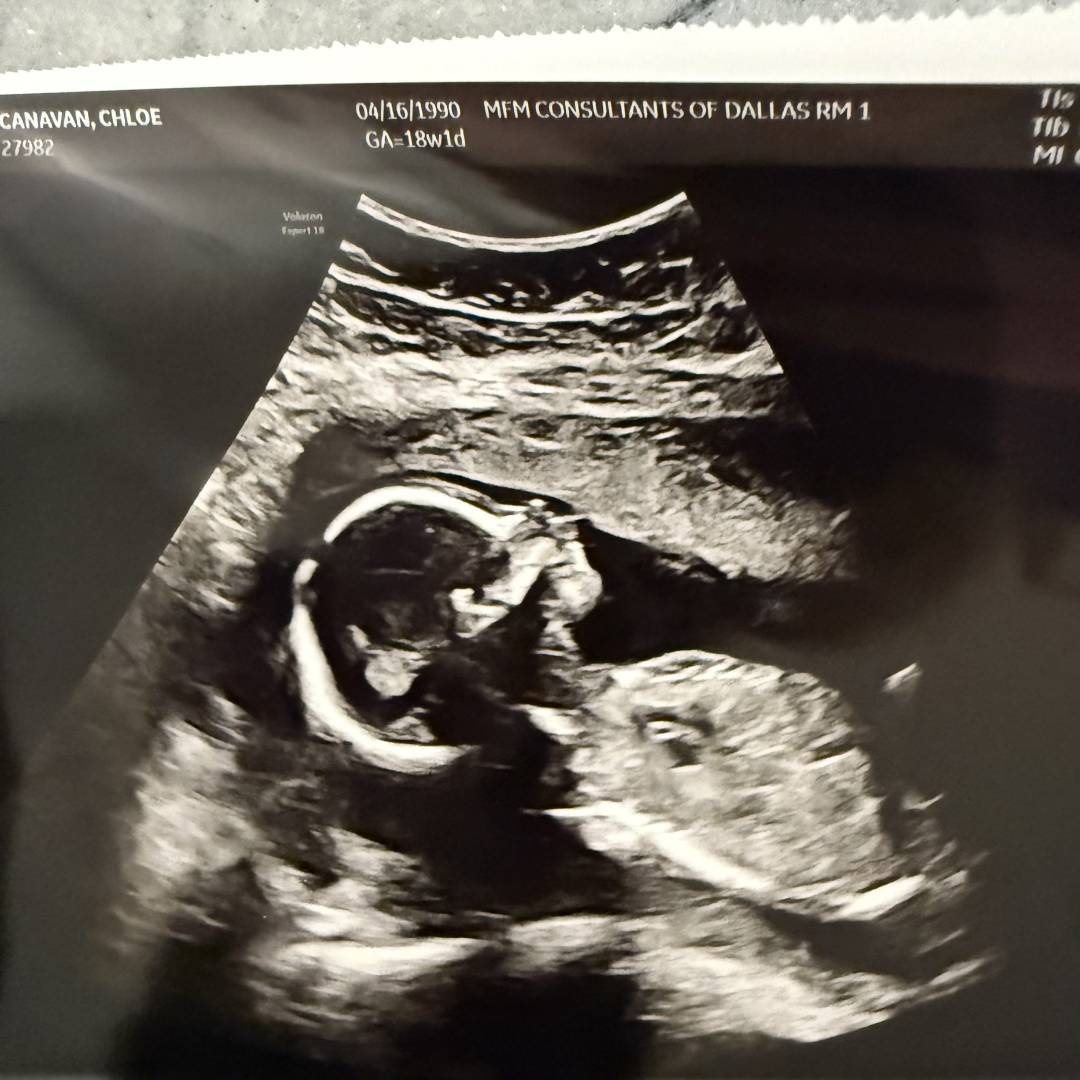 Photo shared by Chloe for their Babylist baby registry.