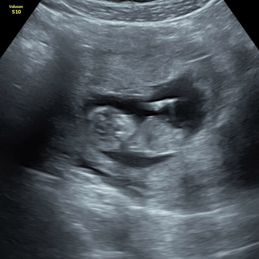 Photo shared by Andrea for their Babylist baby registry.