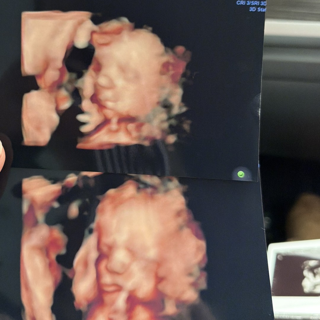 Photo shared by Josie for their Babylist baby registry.