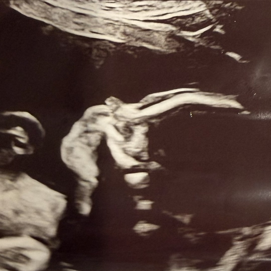 Photo shared by Stephanie for their Babylist baby registry.