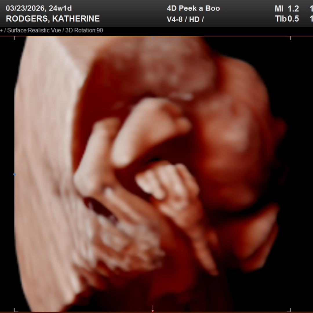 Photo shared by Katherine for their Babylist baby registry.