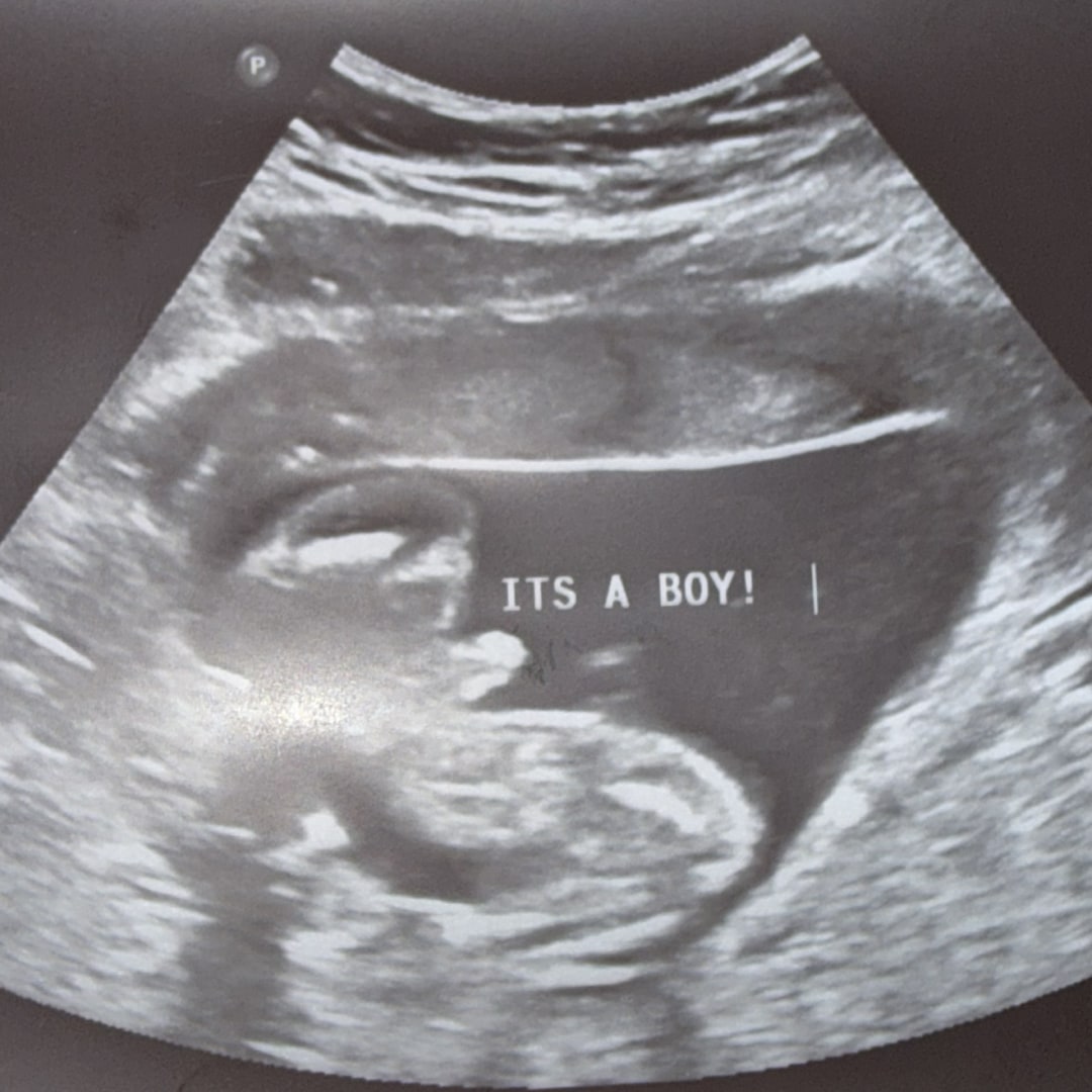 Photo shared by Abbie for their Babylist baby registry.