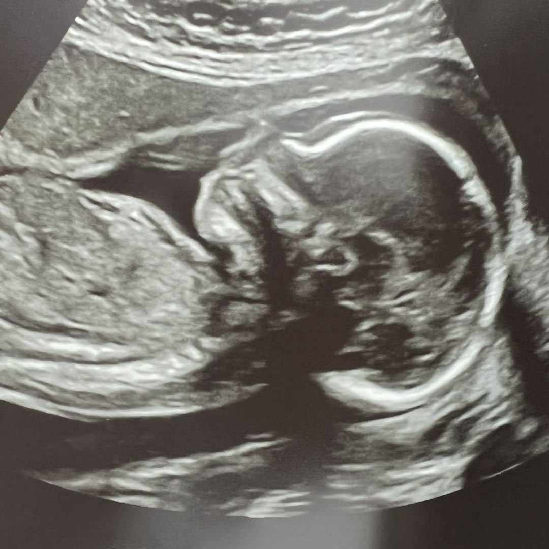 Photo shared by Roseann & Robert for their Babylist baby registry.