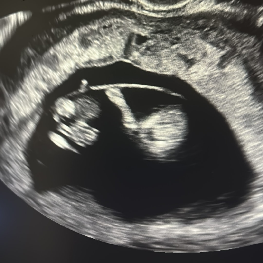 Photo shared by Brenda for their Babylist baby registry.