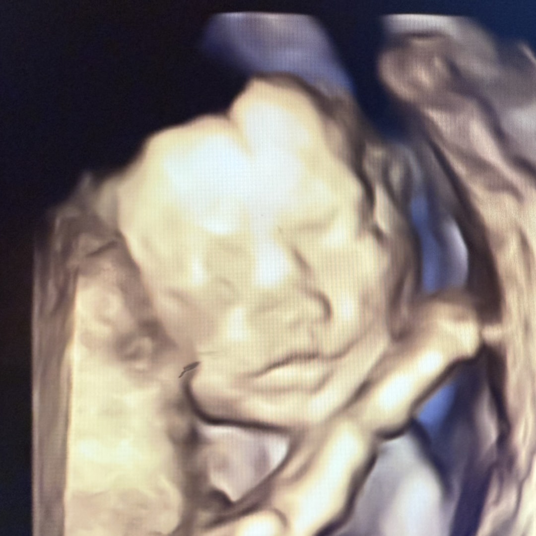 Photo shared by Tay for their Babylist baby registry.