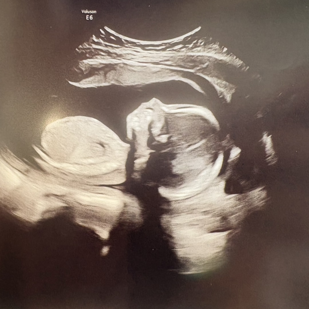 Photo shared by Kaylee for their Babylist baby registry.