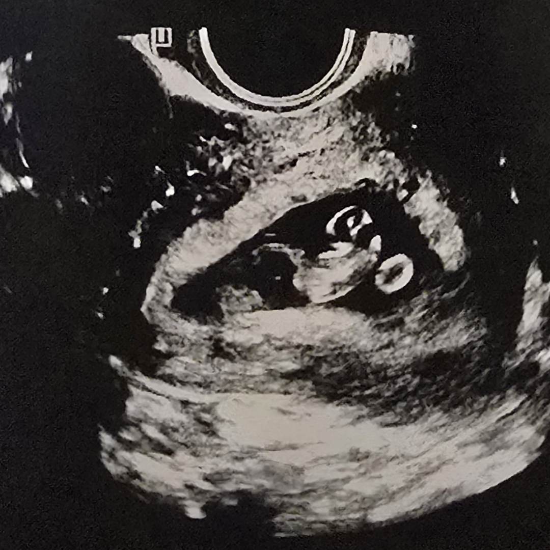 Photo shared by Sage for their Babylist baby registry.