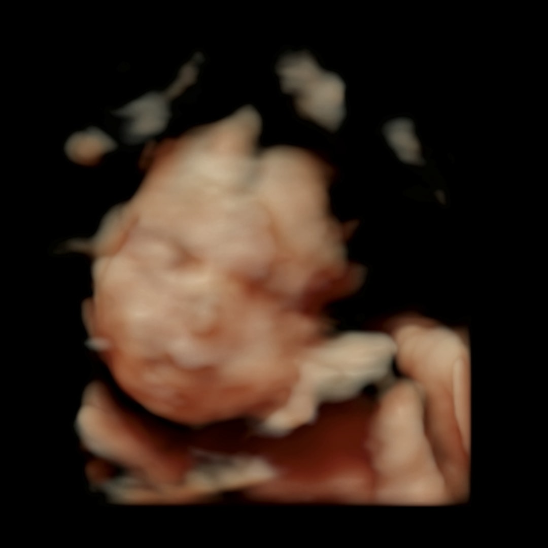 Photo shared by Cindy for their Babylist baby registry.