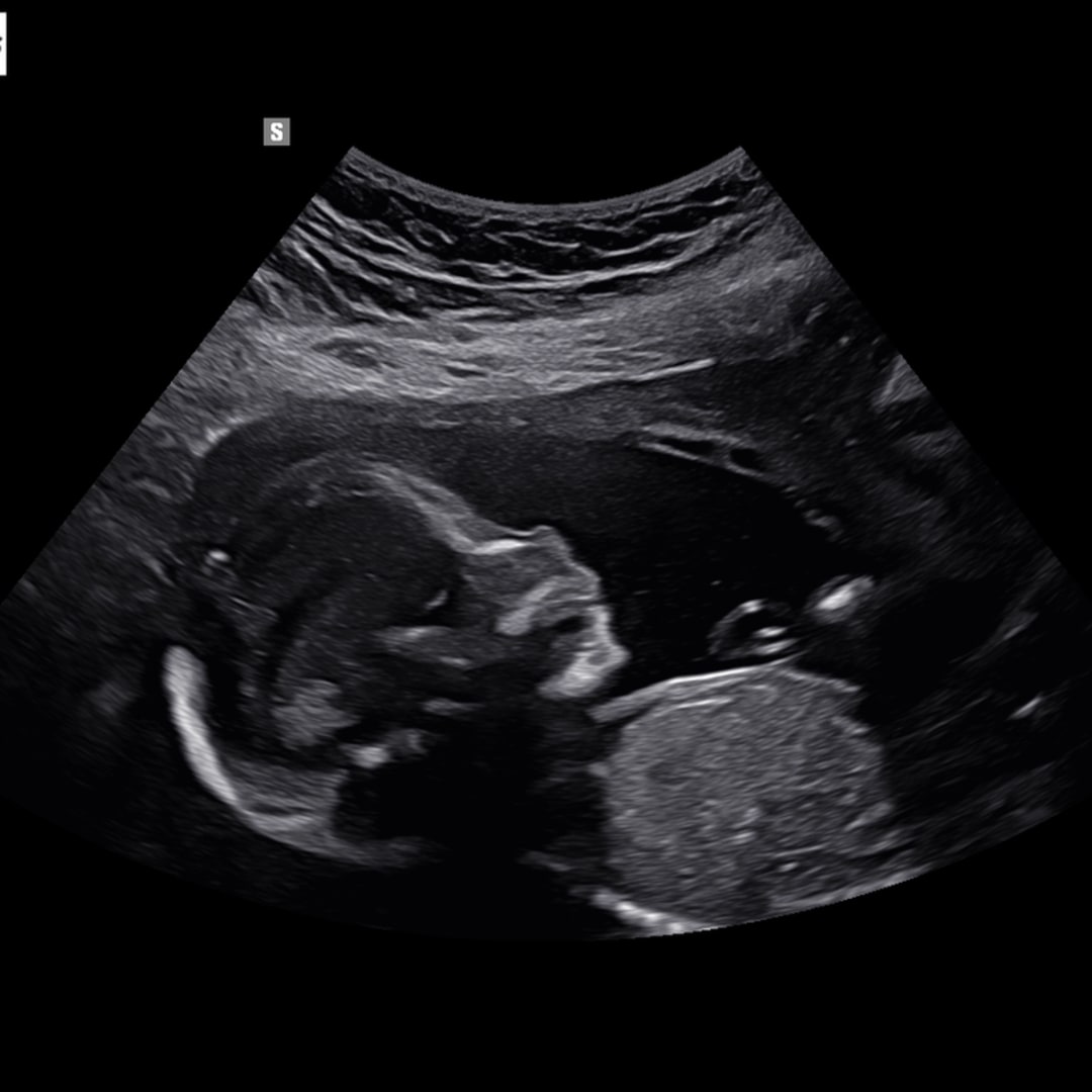 Photo shared by Abby for their Babylist baby registry.