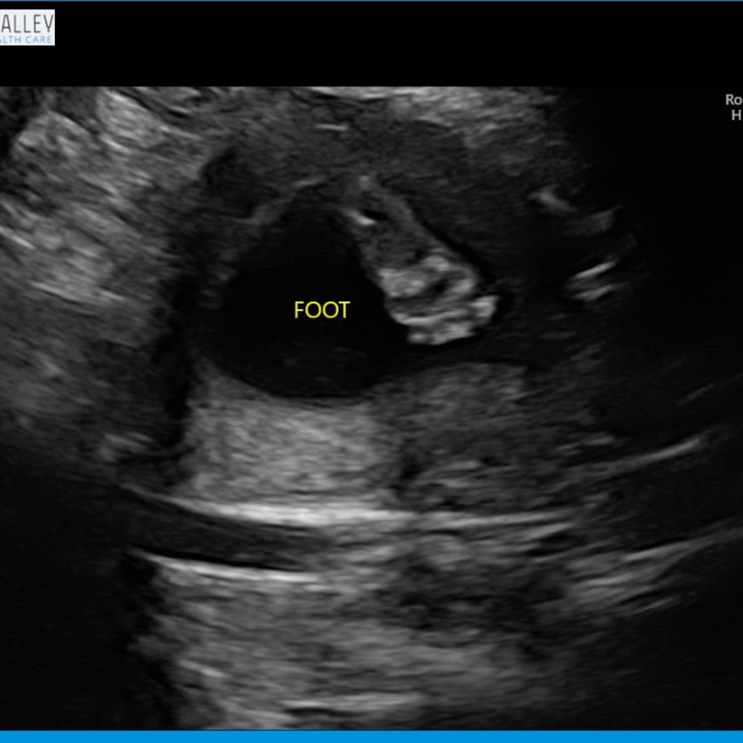 Photo shared by Natalie for their Babylist baby registry.