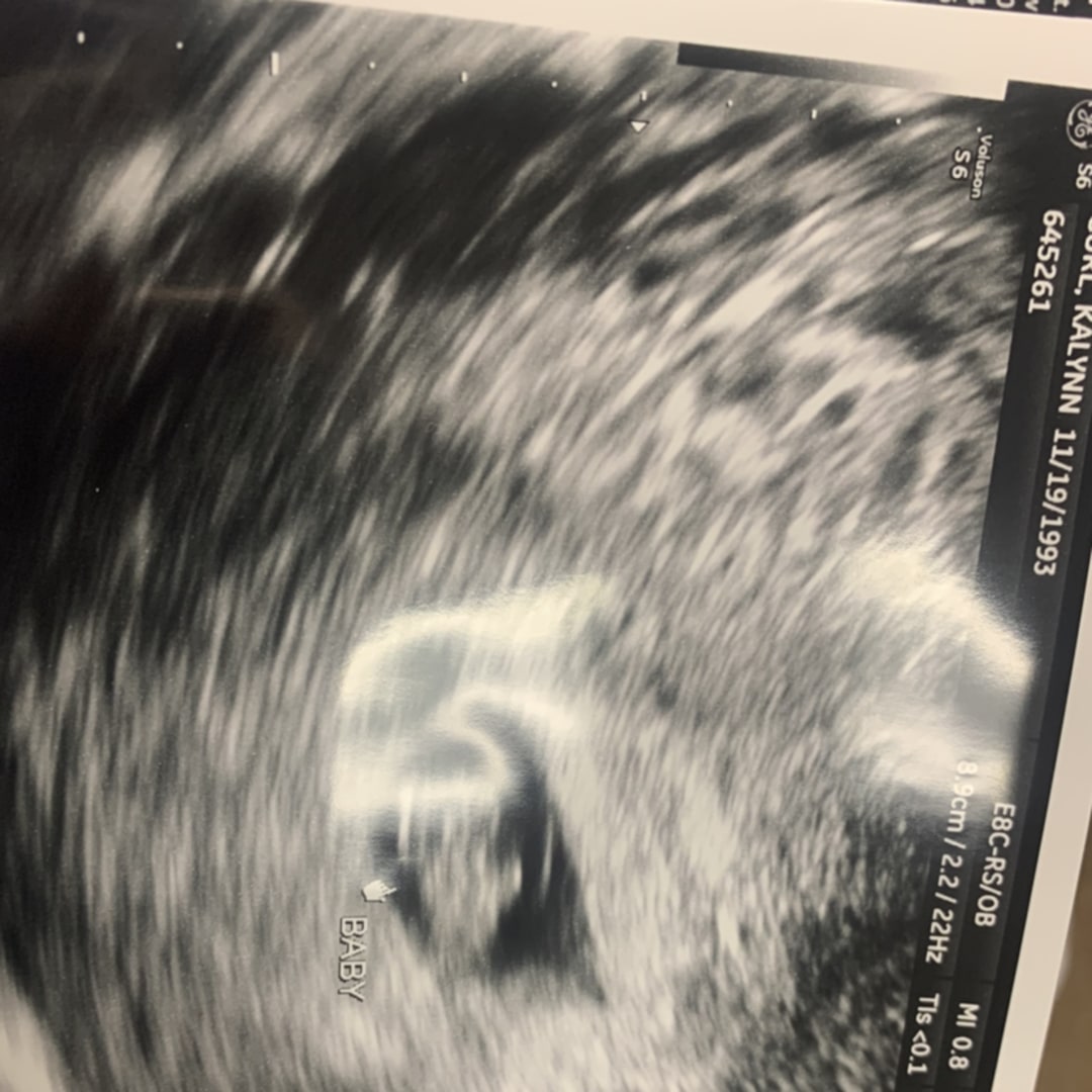 Photo shared by Kalynn for their Babylist baby registry.