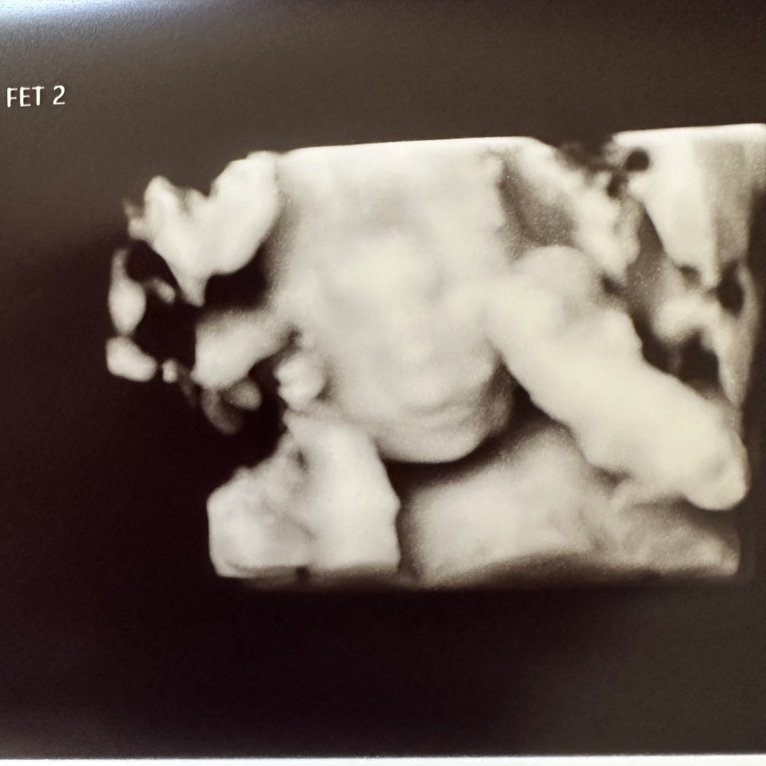 Photo shared by Joscelyn for their Babylist baby registry.