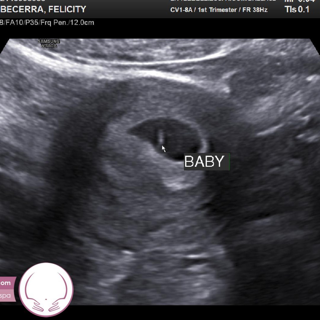 Photo shared by Felicity for their Babylist baby registry.