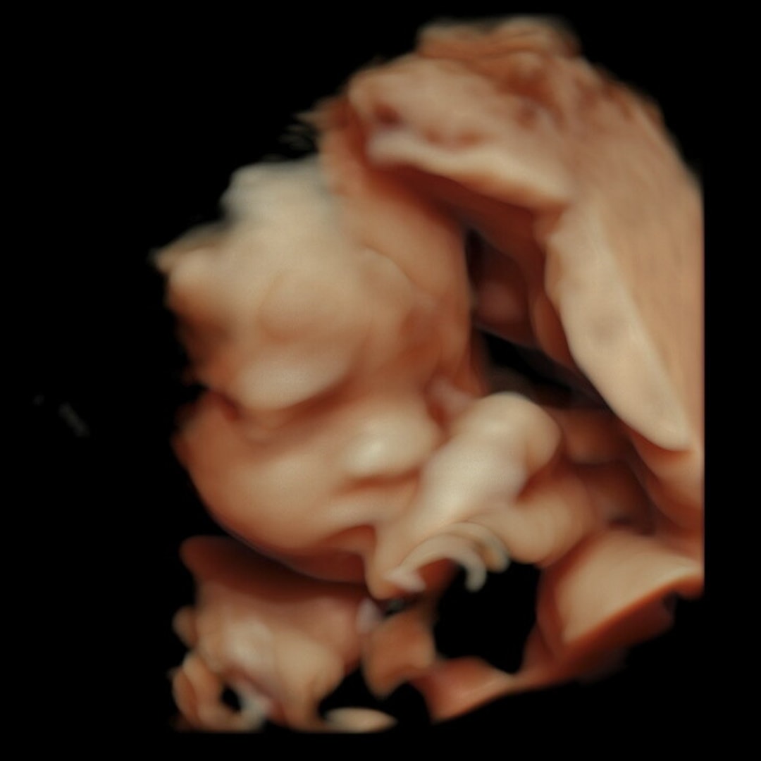 Photo shared by Emily for their Babylist baby registry.