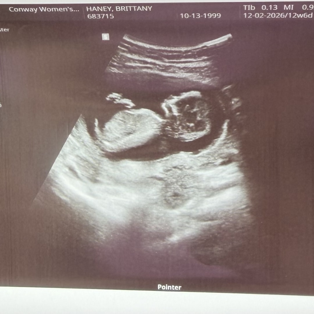 Photo shared by Brittany for their Babylist baby registry.