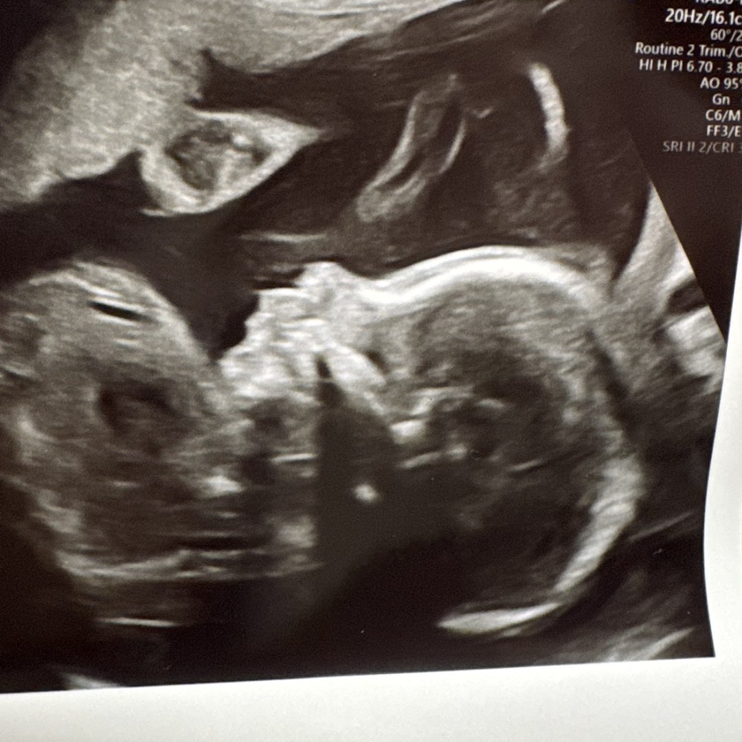 Photo shared by Joseph for their Babylist baby registry.