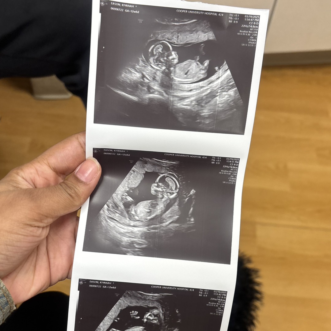 Photo shared by Kiy for their Babylist baby registry.