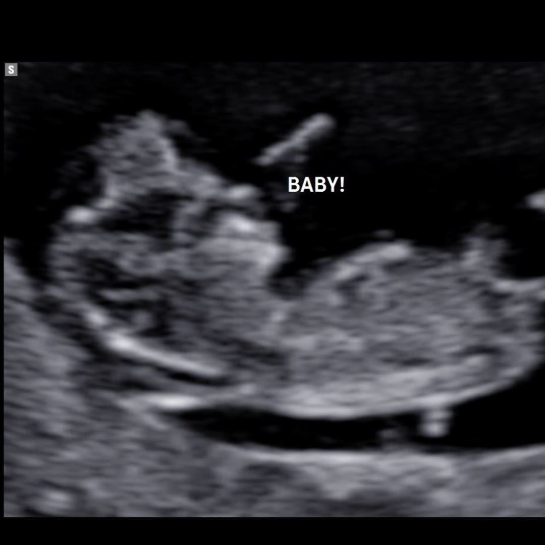 Photo shared by Jared for their Babylist baby registry.