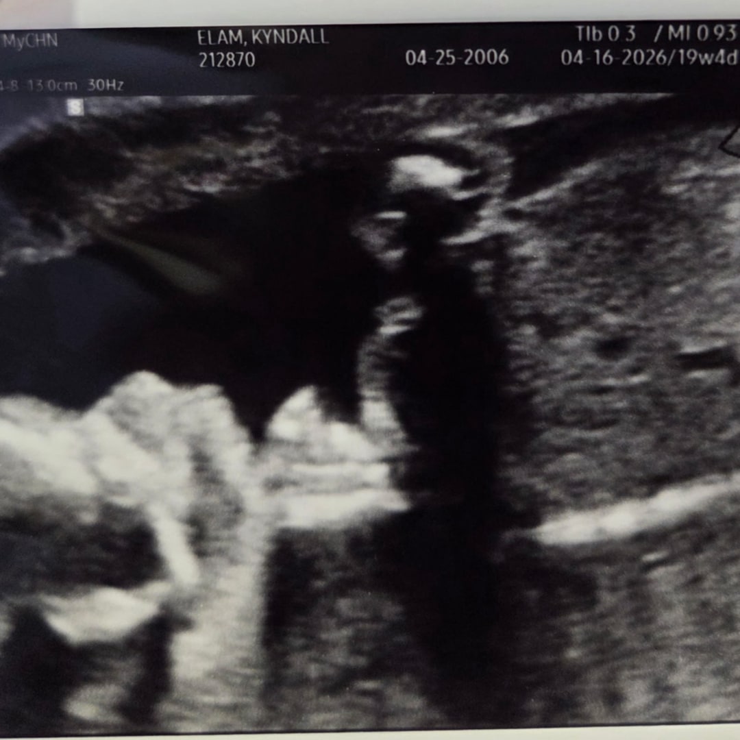 Photo shared by Kyndall for their Babylist baby registry.